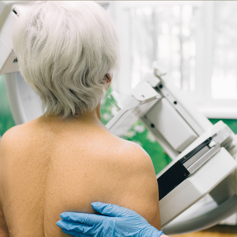 What is mammography?